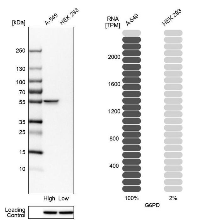 G6PD Antibody