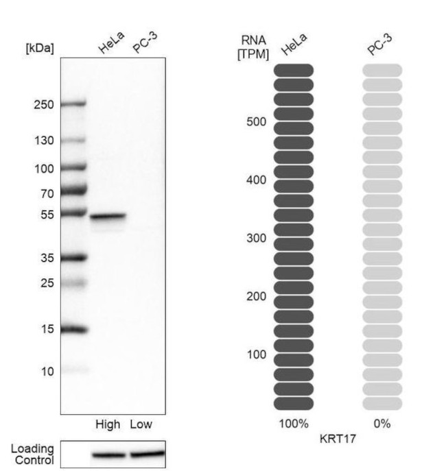 Cytokeratin 17 Antibody