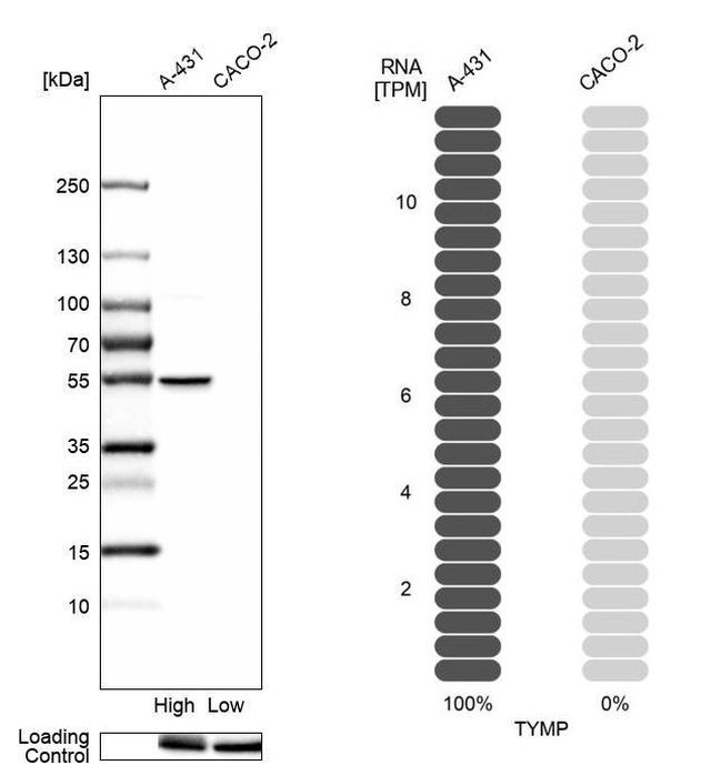 Thymidine Phosphorylase Antibody