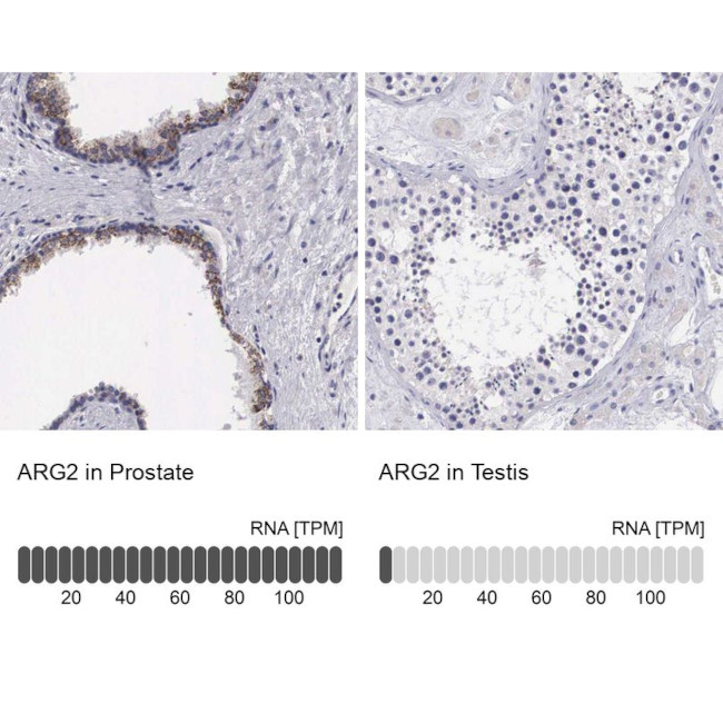 Arginase 2 Antibody