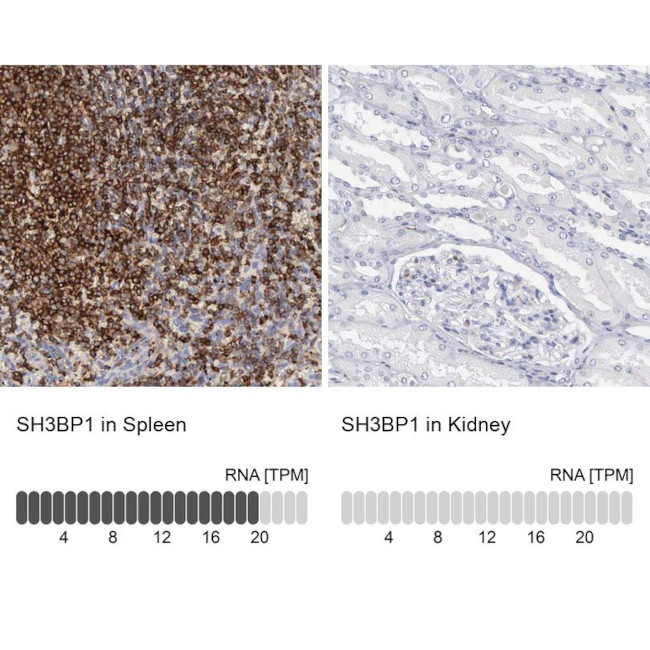 SH3BP1 Antibody