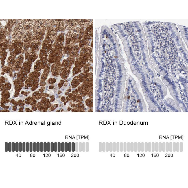 Radixin Antibody