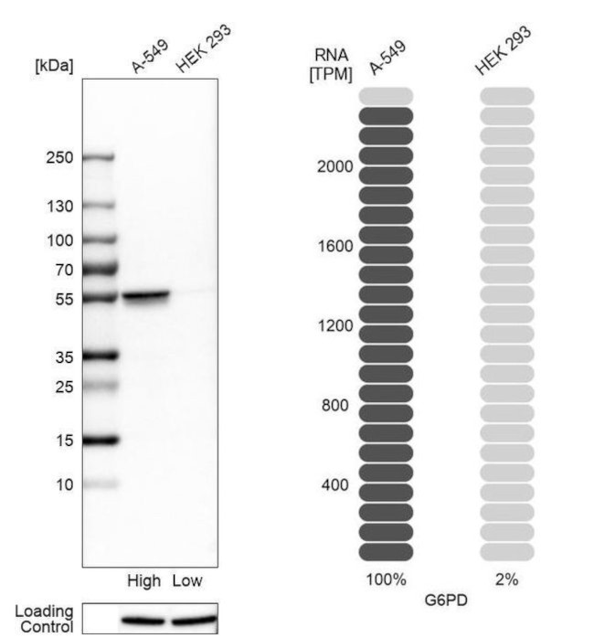 G6PD Antibody