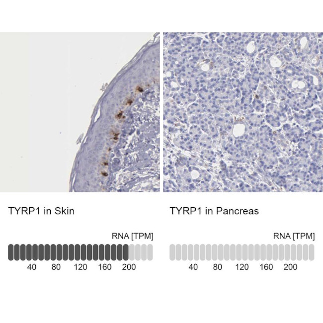 TYRP1 Antibody