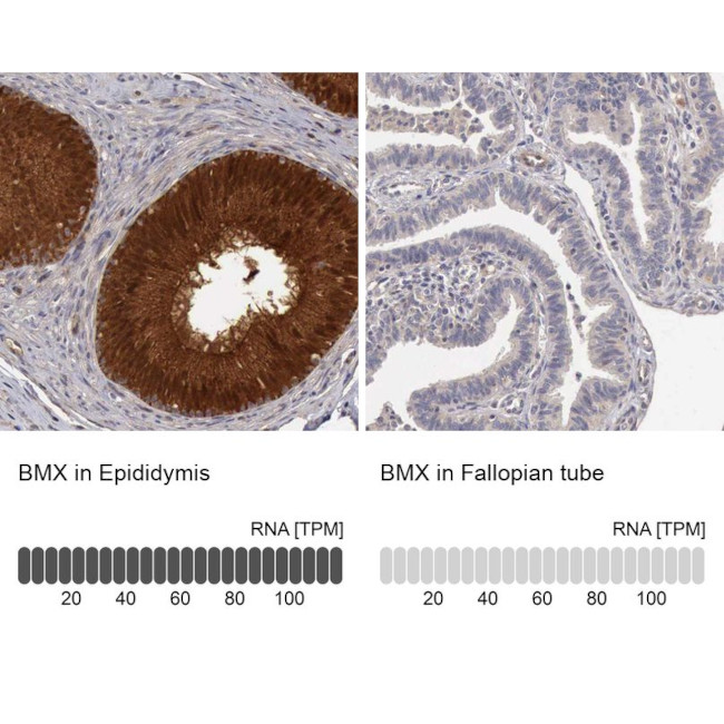 ETK Antibody