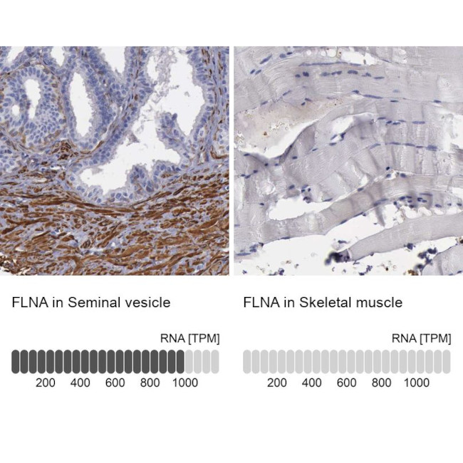 Filamin A Antibody