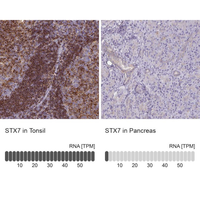 STX7 Antibody