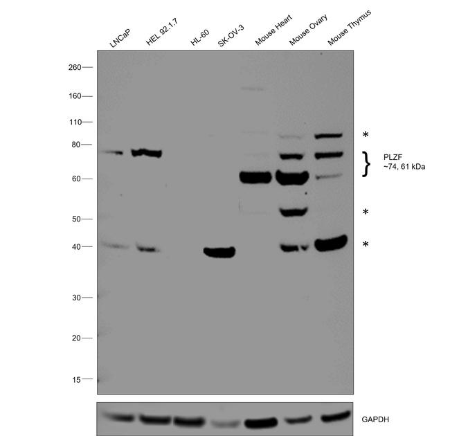 PLZF Antibody in Western Blot (WB)