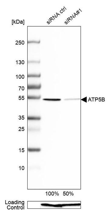 ATP Synthase beta Antibody