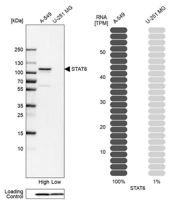 STAT6 Antibody