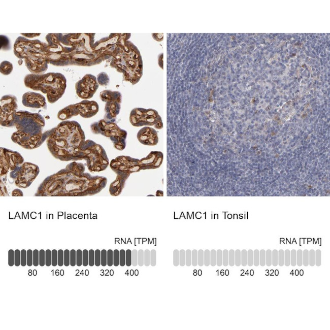 Laminin gamma-1 Antibody