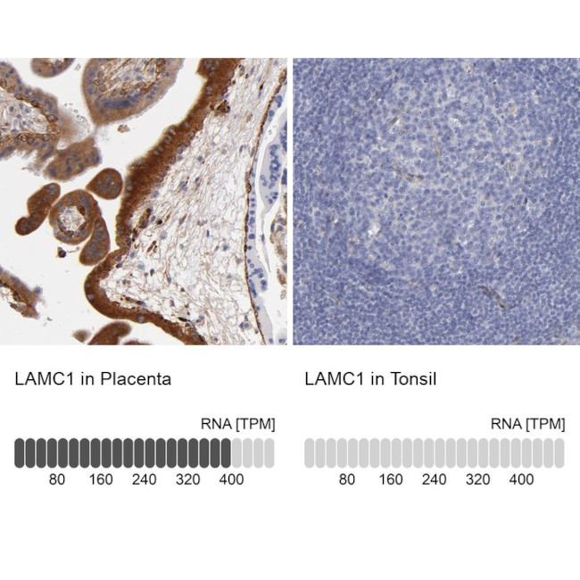 Laminin gamma-1 Antibody