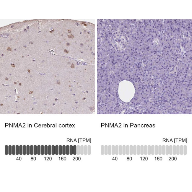 MA2 Antibody