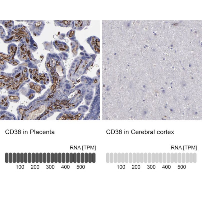 CD36 Antibody