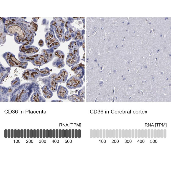 CD36 Antibody