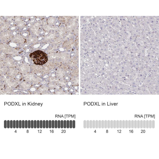 PODXL Antibody