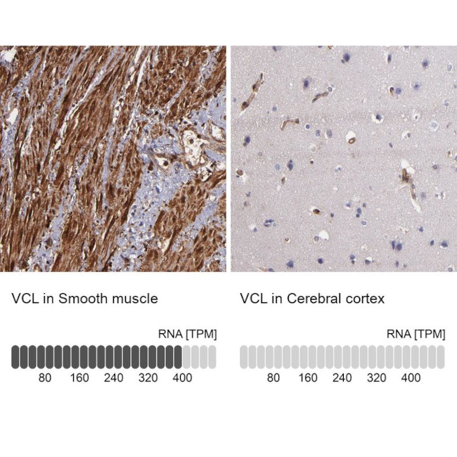 Vinculin Antibody