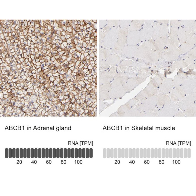 P-Glycoprotein Antibody