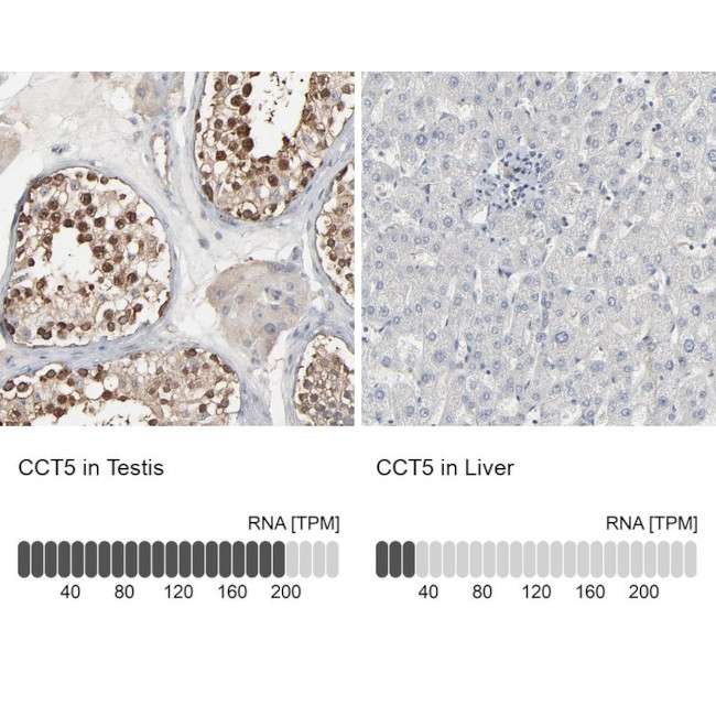 TCP-1 epsilon Antibody