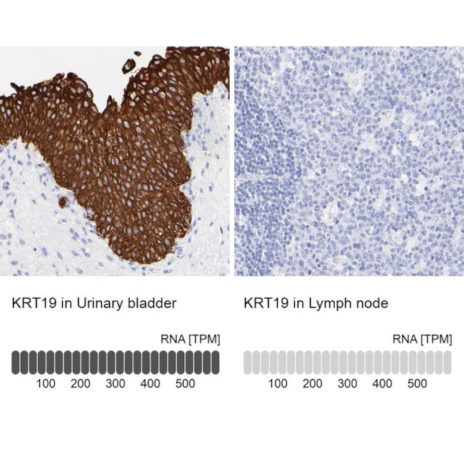 Cytokeratin 19 Antibody