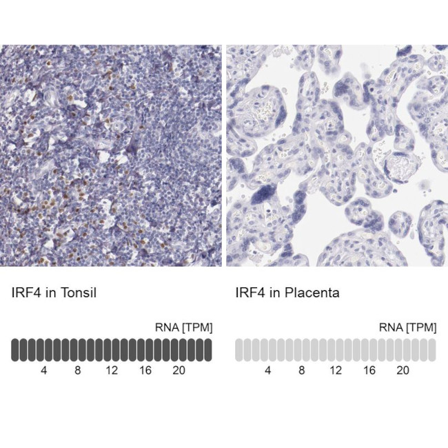 IRF4 Antibody