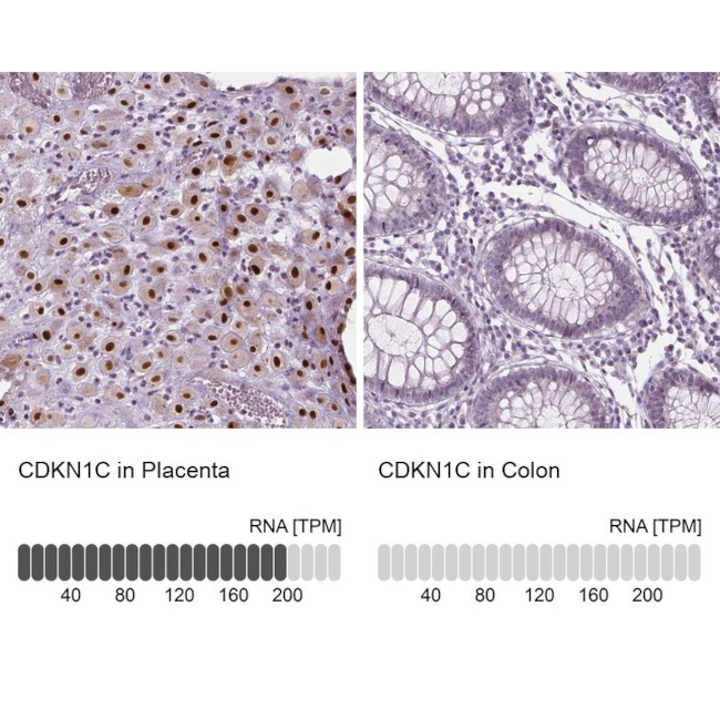 p57 Kip2 Antibody