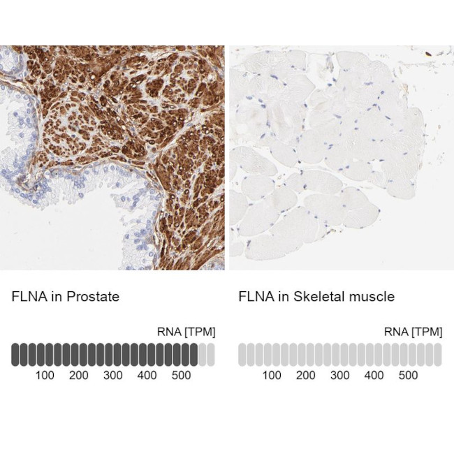 Filamin A Antibody