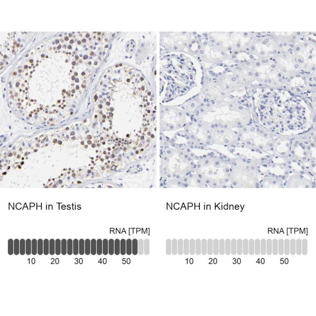 NCAPH Antibody