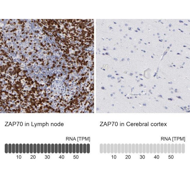 Zap-70 Antibody