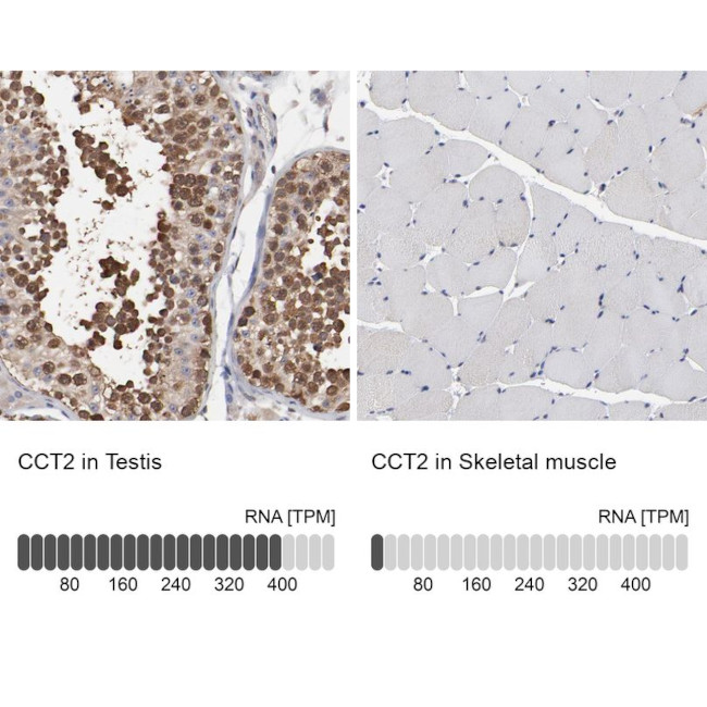 TCP-1 beta Antibody