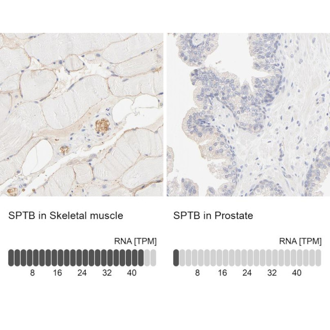 SPTBN1 Antibody