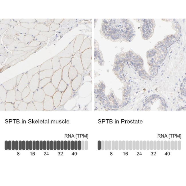 SPTBN1 Antibody