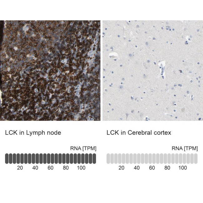 LCK Antibody