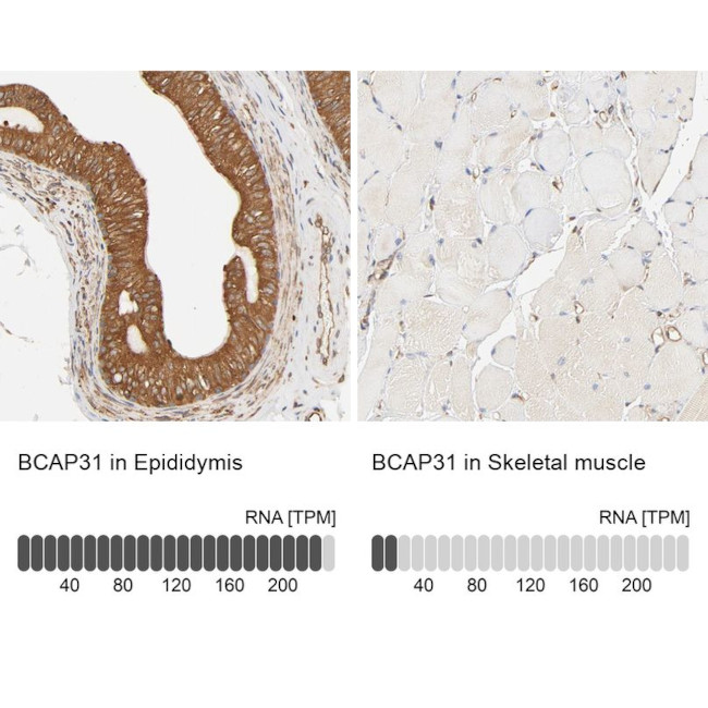 BAP31 Antibody