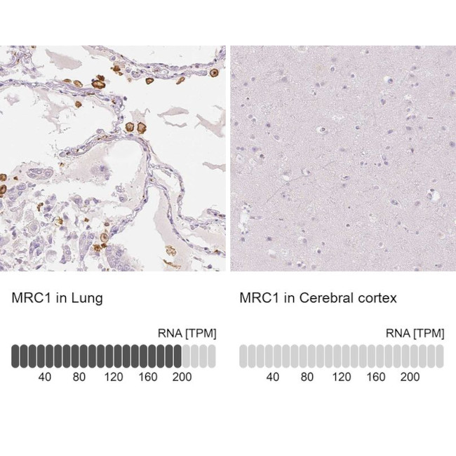 CD206 Antibody