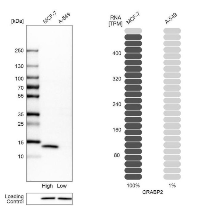 CRABP2 Antibody