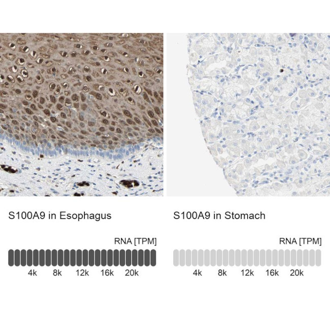 S100A9 Antibody