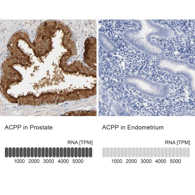 Prostate Specific Acid Phosphatase Antibody