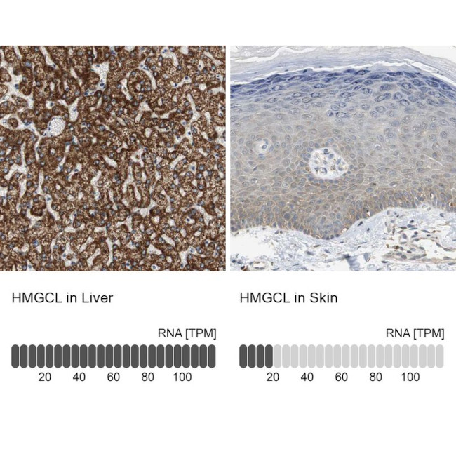 HMGCL Antibody