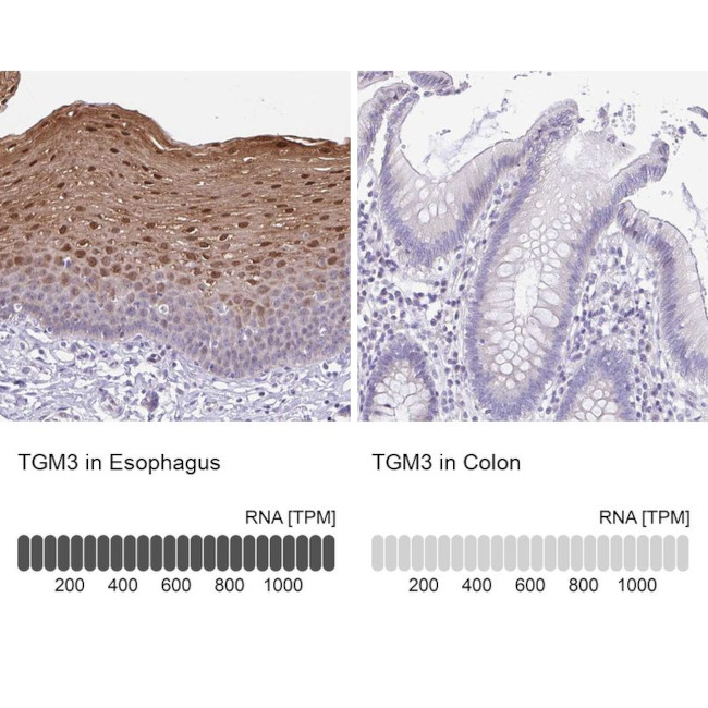 TGM3 Antibody