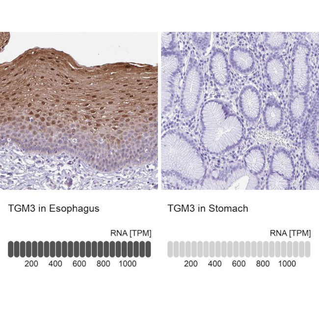 TGM3 Antibody