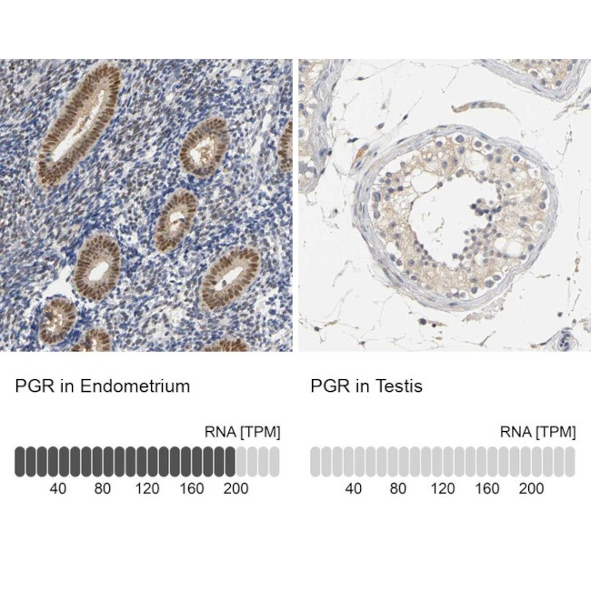 Progesterone Receptor Antibody