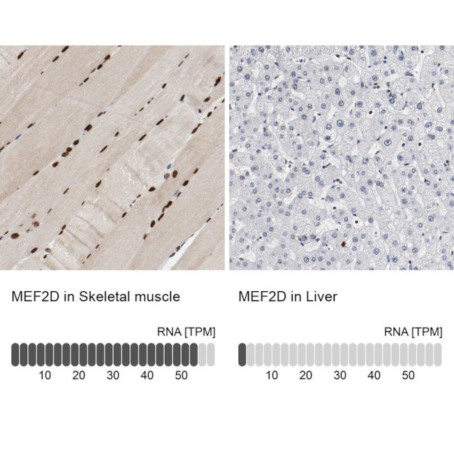 MEF2D Antibody