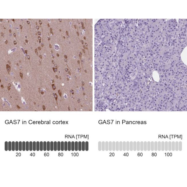 GAS7 Antibody