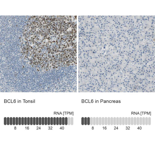 BCL6 Antibody