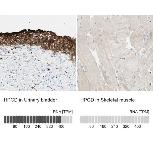 15-PGDH Antibody