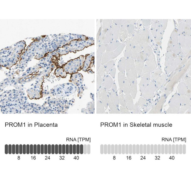 CD133 Antibody