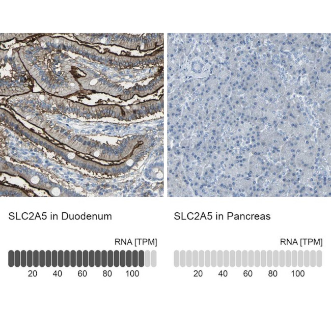 SLC2A5 Antibody