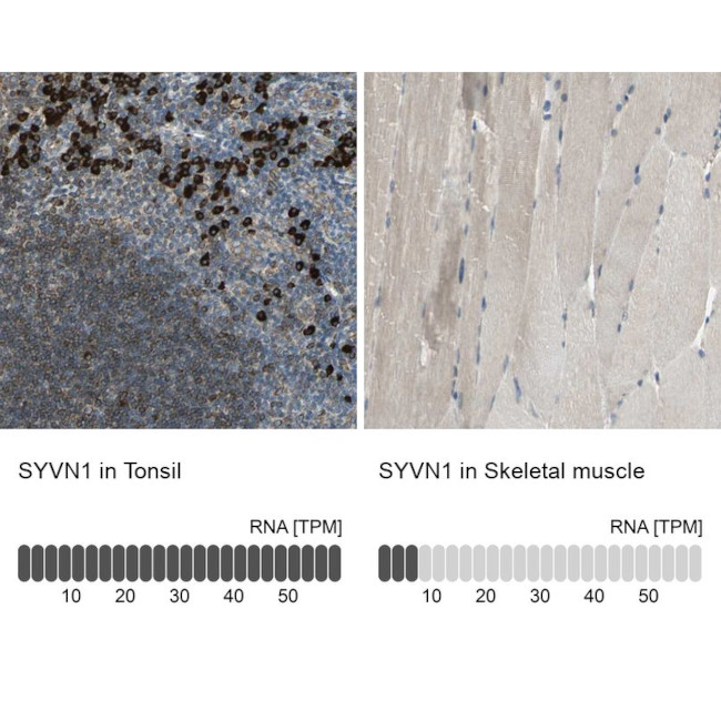 HRD1 Antibody