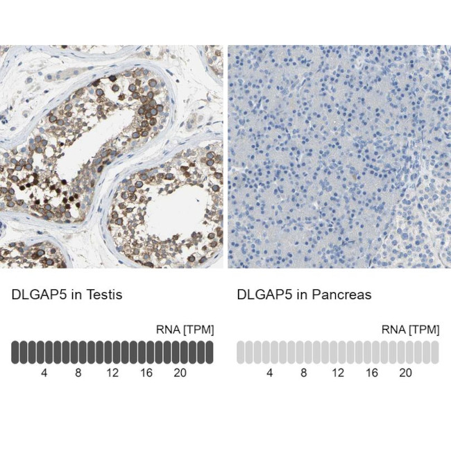 DLG7 Antibody